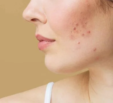 General dermatology