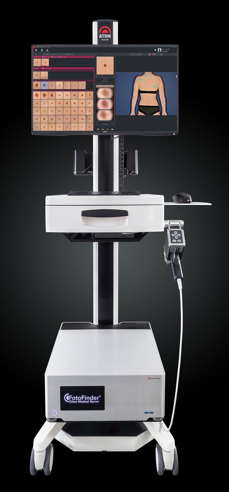 FotoFinder ATBM Master mole mapping system